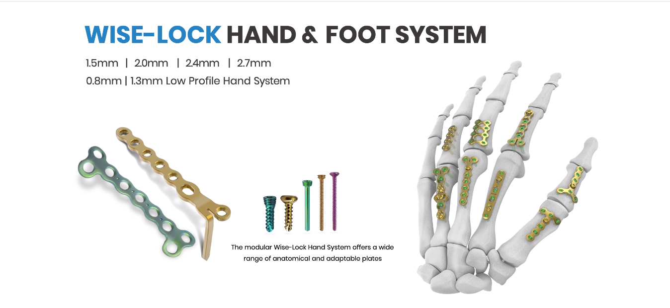 https://www.auxein.com/wise-lock-hand-foot-system/